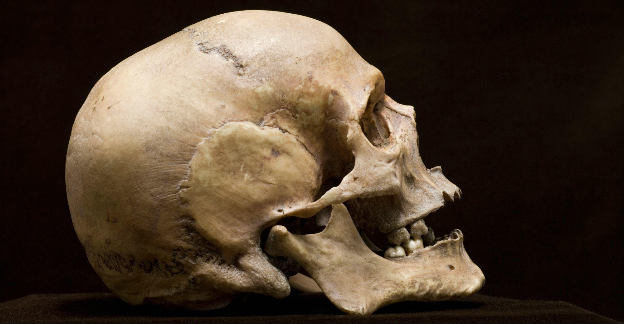 New Study Explains Why Humans Have Chins | Discovery Blog | Discovery