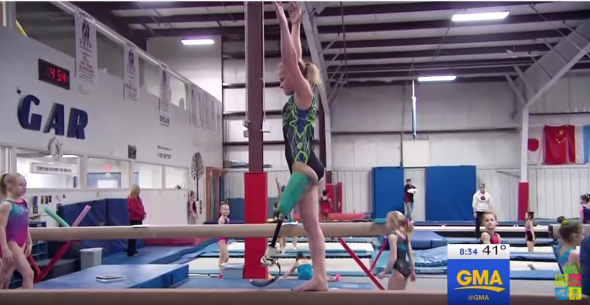 This Amputee Gymnast’s Inspirational Story Will Bring Tears To Your ...