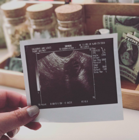 Whitney's Sonogram