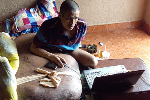 Hai lives in a remote region of Vietnam.
