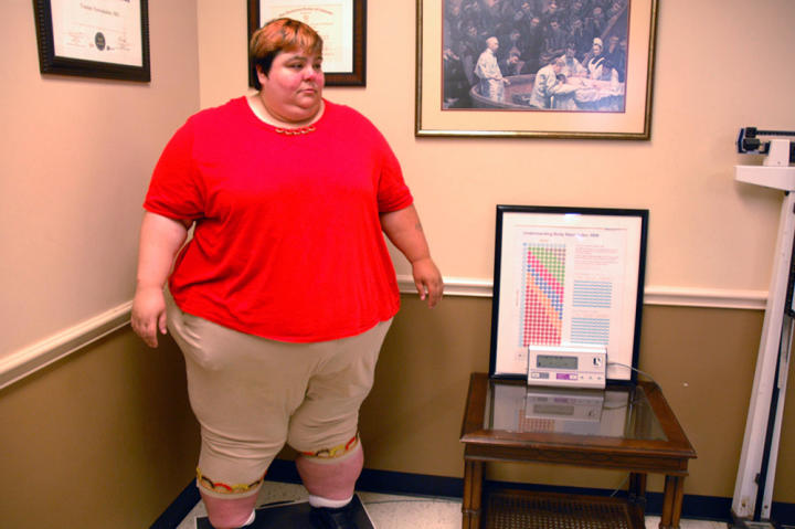 At Dr. Now's office, Paula steps on the scale and learns what her current weight is. "I'm huge," she says. "I look like a monster."