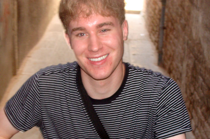 At a young age, Toby was picked on for his looks and decided to change his appearance.