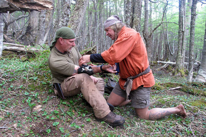 Cody uses moss and wilderness medical skills to dress Dave's wound that was first cauterized with a black powder burn.