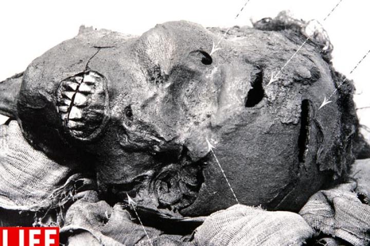 Death of a King. In an Egyptian mummy, salty substances are used to dry the skin before the corpse is dressed with ceremonial oils.