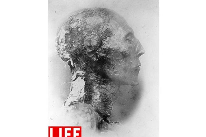 King Seti I. Mummy of Seti I, an Egyptian king of the 19th dynasty, son of Ramses I (1300 BCE) was discovered in 1881 and is now on display at the Cairo Museum.