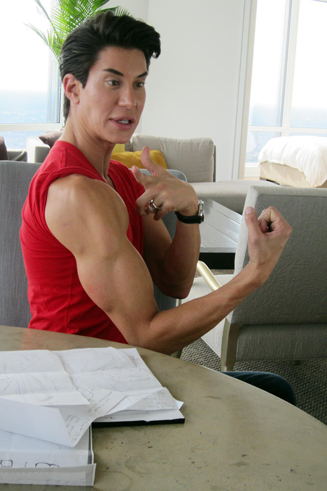 Justin shows off the implants in his arms.