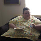 Dr. Nowzaradan performs a lymphedema removal on Christina so she can exercise more frequently and lose more weight. She actually gained 17 pounds before the gastric bypass surgery was scheduled.