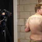 Before: Brandon showing his unwanted tattoo.