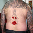 Before: Mark shows his ‘before’ tattoo, with strategically placed stickers.