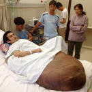 Hai's friends and supporters were integral in drawing renowned plastic surgeon Dr. McKay McKinnon's attention.