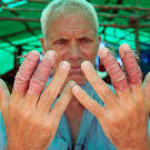 Jeremy with his wrapped fingers to fish.