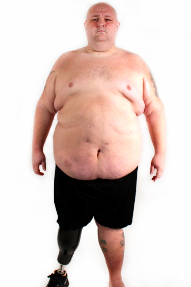 Ultra strength garcinia cambogia 10000 reviews picture 3