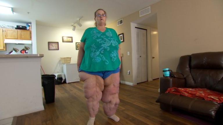 My 600 Lb Life Charity Update | charity s journey in photos my 600 lb life tlc My 600 Lb Life Charity Update | charity s journey in photos my 600 lb life tlc