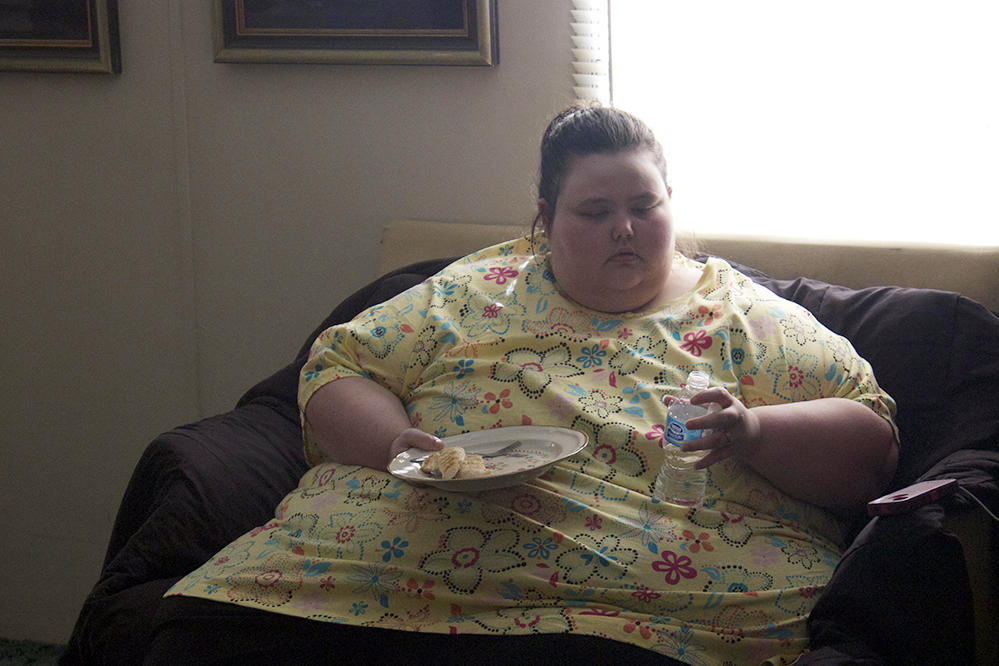 Weight loss surgery orange county ca picture 10