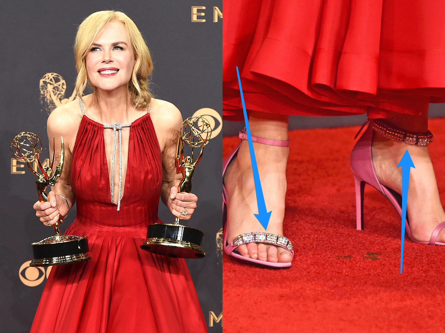 Nicole Kidman Wore Two Different Shoes to the Emmys. Was it Mom Brain ...